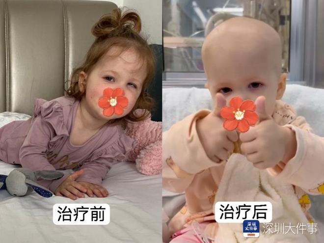 基因治療“逆天改命”！瑞典罕見遺傳病患兒萬里赴粵重獲新生(圖2)