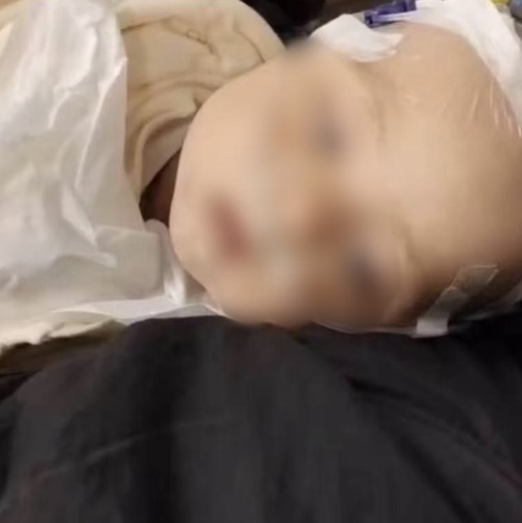 四川6月齡男嬰確診心衰、重癥肺炎：治療缺錢 母親發(fā)起求助(圖2)